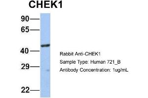Image no. 6 for anti-Checkpoint Kinase 1 (CHEK1) (Middle Region) antibody (ABIN2779737)