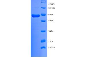 Image no. 1 for NADH Dehydrogenase (Ubiquinone) 1 beta Subcomplex, 7, 18kDa (NDUFB7) (AA 2-137) protein (GST tag) (ABIN5712165)