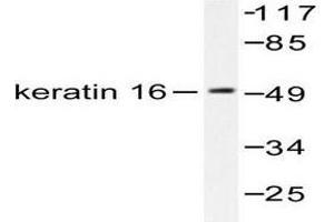 Image no. 1 for anti-Keratin 16 (KRT16) antibody (ABIN265495)
