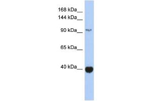 Image no. 1 for anti-Zinc Finger and BTB Domain Containing 4 (ZBTB4) (Middle Region) antibody (ABIN2777794)