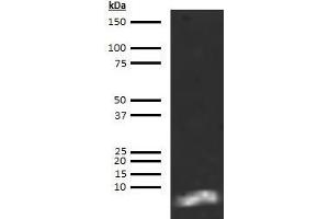 anti-Brain Natriuretic Peptide 45 (BNP-45) antibody