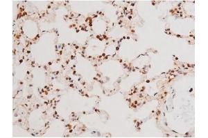 Image no. 10 for anti-Spleen tyrosine Kinase (SYK) (pTyr525) antibody (ABIN6255944)
