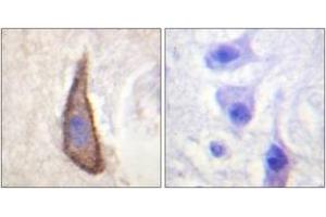 Image no. 2 for anti-CD226 (CD226) (AA 287-336), (pSer329) antibody (ABIN1531541)