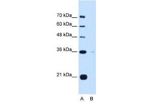 Image no. 1 for anti-Torsin Family 1, Member B (Torsin B) (TOR1B) antibody (ABIN630472)