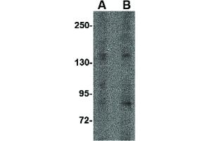 Image no. 3 for anti-Interleukin 16 (IL16) (N-Term) antibody (ABIN6656526)