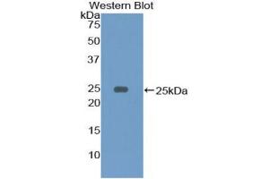 Image no. 2 for anti-B-cell antigen receptor complex-associated protein alpha chain (CD79A) (AA 36-219) antibody (ABIN1859291)