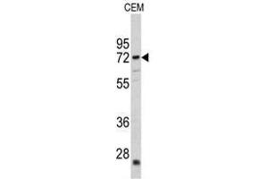 Image no. 1 for anti-Carnitine O-Acetyltransferase (CRAT) (N-Term) antibody (ABIN452873)