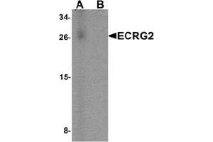 Image no. 2 for anti-Serine Peptidase Inhibitor, Kazal Type 7 (SPINK7) (C-Term) antibody (ABIN1450063)