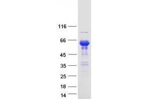 Syntrophin, beta 1 (Dystrophin-Associated Protein A1, 59kDa, Basic Component 1) (SNTB1) protein (Myc-DYKDDDDK Tag)
