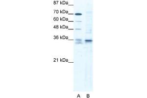 Image no. 1 for anti-SRY (Sex Determining Region Y)-Box 12 (SOX12) (C-Term) antibody (ABIN2777869)
