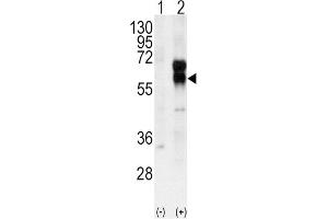 Image no. 1 for anti-Activin A Receptor Type II-Like 1 (ACVRL1) antibody (ABIN3003504)