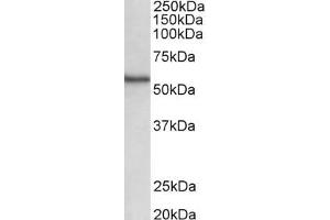 Image no. 1 for anti-serine/threonine Kinase 38 (STK38) (C-Term) antibody (ABIN870638)