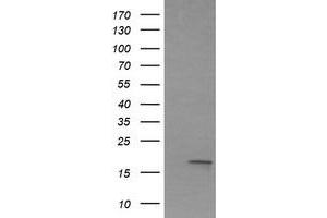 Image no. 3 for anti-Interleukin 1 Family Member 9 (IL1F9) antibody (ABIN1498873)