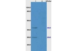 Image no. 2 for anti-Killer Cell Lectin-Like Receptor Subfamily B, Member 1 (KLRB1) (AA 151-225) antibody (ABIN680998)