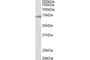 Image no. 2 for anti-Ectodermal-Neural Cortex 1 (With BTB-Like Domain) (ENC1) (Internal Region) antibody (ABIN5539762)