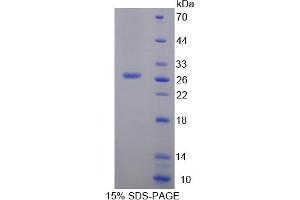 Image no. 1 for Prolyl 4-Hydroxylase, beta Polypeptide (P4HB) (AA 309-525) protein (His tag) (ABIN6236752)