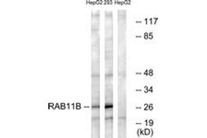 Image no. 1 for anti-RAB11B, Member RAS Oncogene Family (RAB11B) (AA 164-213) antibody (ABIN1535269)