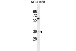 Image no. 1 for anti-V-Set and Transmembrane Domain Containing 4 (VSTM4) (AA 149-177), (Middle Region) antibody (ABIN950711)