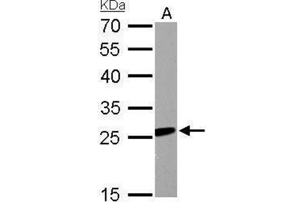 anti-Regulator of G-Protein Signaling 2 (RGS2) (Center) antibody