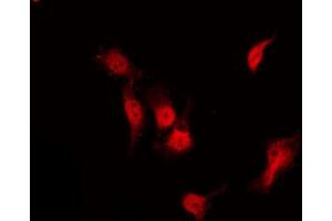 Image no. 2 for anti-Histone Deacetylase 3 (HDAC3) (pSer424) antibody (ABIN6256332)
