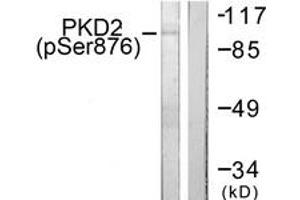 Western blot analysis of extracts from NIH-3T3 cells treated with PMA 250ng/ml 15', using PKD2 (Phospho-Ser876) Antibody.
