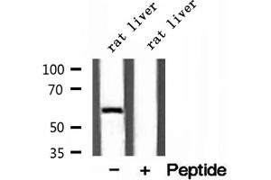 Image no. 2 for anti-D-2-Hydroxyglutarate Dehydrogenase (D2HGDH) (C-Term) antibody (ABIN6261211)