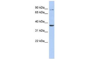 Image no. 1 for anti-Heparan Sulfate (Glucosamine) 3-O-Sulfotransferase 1 (HS3ST1) (Middle Region) antibody (ABIN2777744)