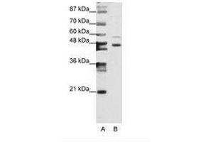 Image no. 1 for anti-Zinc Finger Protein 558 (ZNF558) (N-Term) antibody (ABIN6736180)