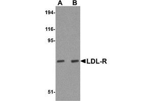 Image no. 1 for anti-Low Density Lipoprotein Receptor (LDLR) (Middle Region) antibody (ABIN1030978)