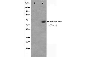Image no. 2 for anti-V-Akt Murine Thymoma Viral Oncogene Homolog 1 (AKT1) (pThr450) antibody (ABIN6256564)