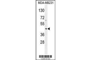 Image no. 1 for anti-Killer Cell Immunoglobulin-Like Receptor, Two Domains, Long Cytoplasmic Tail, 2 (KIR2DL2) (C-Term) antibody (ABIN2488800)