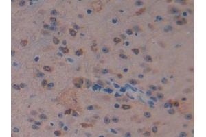 Image no. 3 for anti-Macrophage Stimulating 1 (Hepatocyte Growth Factor-Like) (MST1) (AA 469-704) antibody (ABIN1859890)