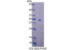 Image no. 1 for BCL2-Associated Athanogene 5 (BAG5) (AA 1-172) protein (His tag) (ABIN6239581)