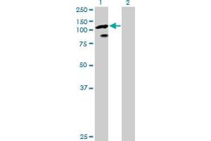 Image no. 1 for anti-Transcription Elongation Factor B (SIII), Polypeptide 3 (110kDa, Elongin A) (TCEB3) (AA 1-772) antibody (ABIN520751)