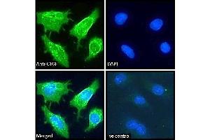 Image no. 1 for anti-Connective Tissue Growth Factor (CTGF) (Internal Region) antibody (ABIN6391344)
