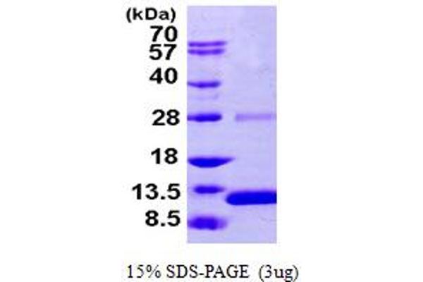 S100A2 Protein (AA 1-97) (His tag)