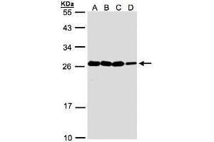 WB Image Sample(30 ug whole cell lysate) A:A431, B:H1299 C:HeLa S3, D:Hep G2 , 12% SDS PAGE antibody diluted at 1:1000