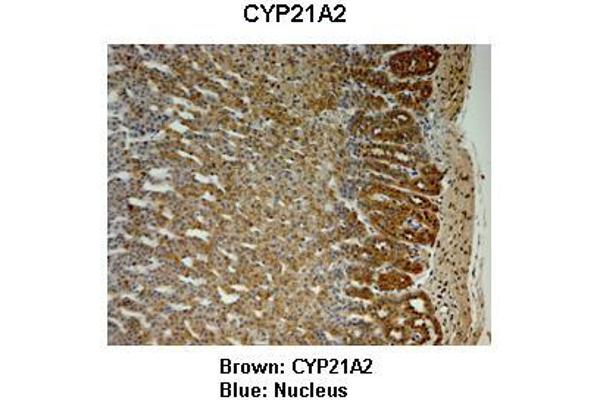 anti-Cytochrome P450, Family 21, Subfamily A, Polypeptide 2 (CYP21A2) (C-Term) antibody