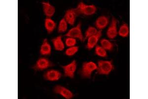 Image no. 1 for anti-Synovial Sarcoma Translocation, Chromosome 18 (SS18) (N-Term) antibody (ABIN6265410)