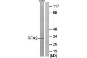 Image no. 3 for anti-Replication Protein A2, 32kDa (RPA2) (AA 10-59) antibody (ABIN1532646)