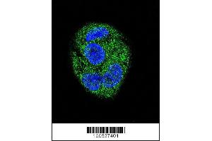 Image no. 4 for anti-Kv Channel Interacting Protein 3, Calsenilin (KCNIP3) (N-Term) antibody (ABIN2489363)