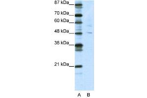 Image no. 2 for anti-Pleiomorphic Adenoma Gene-Like 1 (PLAGL1) (N-Term) antibody (ABIN2780800)