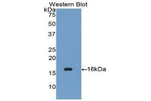 Image no. 1 for anti-Chemokine (C-C Motif) Ligand 27 (CCL27) (AA 25-112) antibody (ABIN1174874)