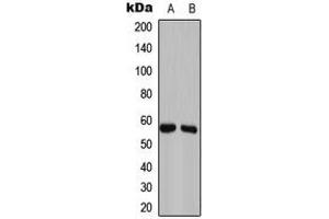 Image no. 2 for anti-Growth Arrest-Specific 8 (GAS8) (Center) antibody (ABIN2706208)