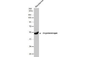 Image no. 6 for anti-Angiotensinogen (serpin Peptidase Inhibitor, Clade A, Member 8) (AGT) (Center) antibody (ABIN2855709)