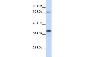 Image no. 1 for anti-UDP-Gal:betaGlcNAc beta 1,3-Galactosyltransferase, Polypeptide 1 (B3GALT1) (C-Term) antibody (ABIN2783817)