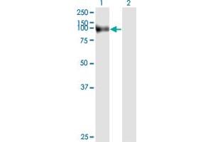 Image no. 4 for anti-Fibroblast Activation Protein, alpha (FAP) (AA 525-624) antibody (ABIN560844)