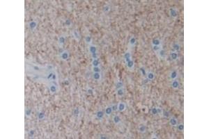 Image no. 2 for anti-Nephroblastoma Overexpressed (NOV) (AA 139-357) antibody (ABIN5013997)