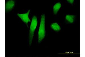 Immunofluorescence of monoclonal antibody to PTPN12 on HeLa cell.