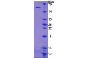 Image no. 1 for Thymidine Kinase 1, Soluble (TK1) (AA 2-234) protein (His tag,GST tag) (ABIN6236918)